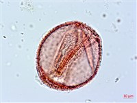 阿里山忍冬、漸尖葉忍冬藏品圖，第1張