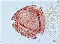 阿里山忍冬、漸尖葉忍冬藏品圖，第2張