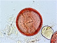 阿里山忍冬、漸尖葉忍冬藏品圖，第3張