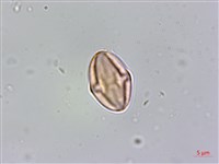 厚葉秋海棠藏品圖，第3張