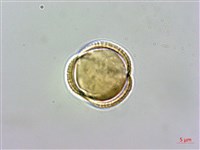 基隆筷子芥藏品圖，第2張