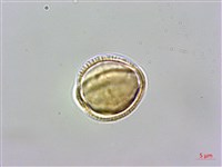 基隆筷子芥藏品圖，第3張