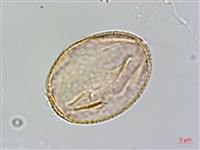 恆春厚殼樹藏品圖，第3張