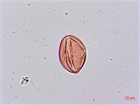 倒吊蓮、匙葉燈籠草藏品圖，第2張