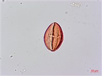 倒吊蓮、匙葉燈籠草藏品圖，第3張