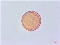 蘭嶼蘋婆藏品圖，第2張