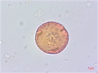 蘭嶼蘋婆藏品圖，第4張