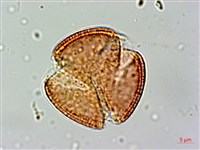 腺果藤、刺藤藏品圖，第2張