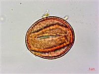 腺果藤、刺藤藏品圖，第3張