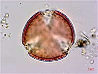 腺果藤、刺藤藏品圖，第4張