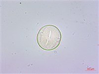 鵝掌蘗藏品圖，第2張