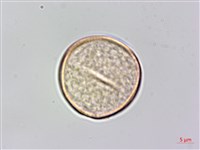 沙楠子樹藏品圖，第2張