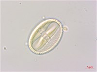 垂枝泡花樹藏品圖，第1張