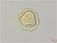 垂枝泡花樹藏品圖，第2張