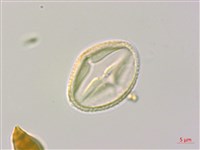 垂枝泡花樹藏品圖，第3張