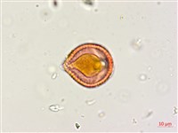 木豆藏品圖，第3張