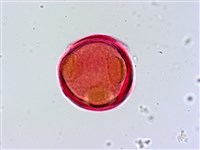 針刺草藏品圖，第3張