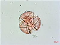 棋盤腳樹藏品圖，第2張