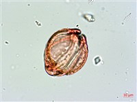 棋盤腳樹藏品圖，第4張