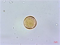 紅頭李欖, 蘭嶼李欖藏品圖，第3張