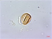 紅頭李欖, 蘭嶼李欖藏品圖，第4張