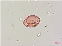 印度田菁藏品圖，第3張