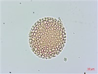 白瑞香藏品圖，第3張