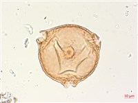 水丁香藏品圖，第1張