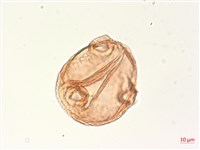 水丁香藏品圖，第2張