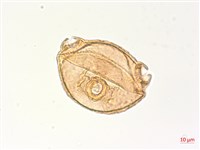 水丁香藏品圖，第3張