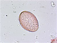 臺灣油點草藏品圖，第3張