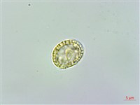 蘭嶼土防己藏品圖，第1張