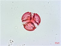 棋盤腳樹藏品圖，第2張