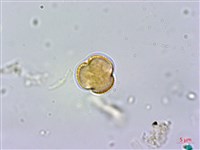 紅頭李欖, 蘭嶼李欖藏品圖，第2張