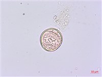 蘭嶼八角金盤藏品圖，第3張