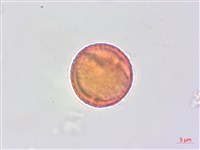 蘭嶼蘋婆藏品圖，第3張