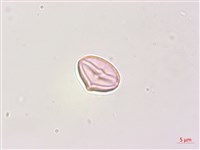 瑪瑙珠、黃果龍葵藏品圖，第1張