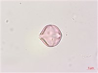 瑪瑙珠、黃果龍葵藏品圖，第3張