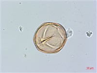 山柿, 山豆柿藏品圖，第3張