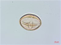 山柿, 山豆柿藏品圖，第4張