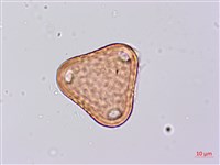 台灣山黑扁豆藏品圖，第1張