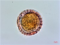 壺花莢迷藏品圖，第2張