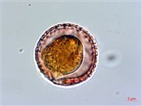 壺花莢迷藏品圖，第3張