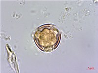 紅子佛甲草藏品圖，第2張