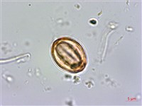 紅子佛甲草藏品圖，第4張