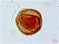 阿里山忍冬、漸尖葉忍冬藏品圖，第2張