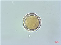 高山馬先蒿藏品圖，第2張