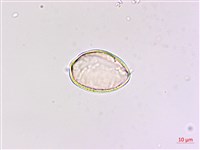 七葉一枝花藏品圖，第2張