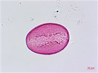 臺灣油點草藏品圖，第2張