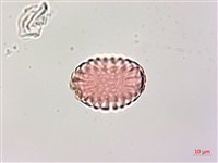 小扁豆藏品圖，第2張